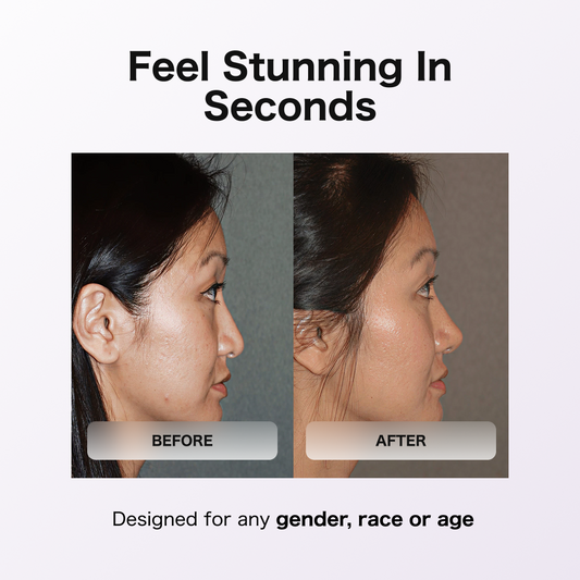 Lift & Sculpt Your Nose in Seconds